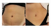 BioRepeel Body