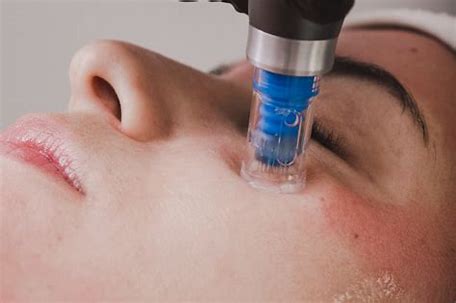 Skin Needling Dermapen 4 Standard